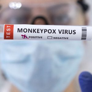 How to protect yourself against monkeypox, what to do if you catch it